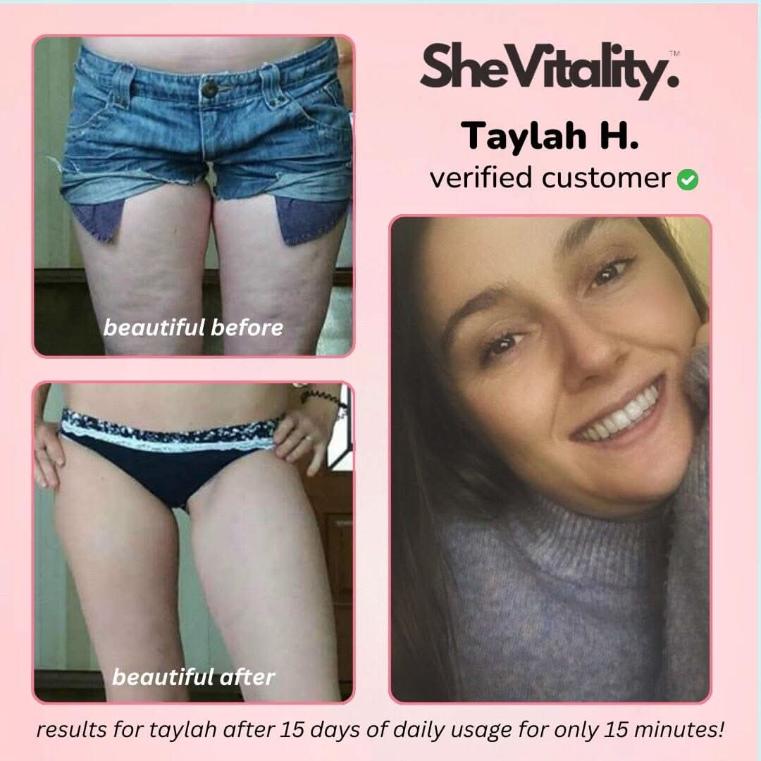 SheVitality™ Cellulite Relief Kit