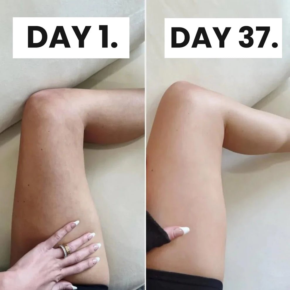 SheVitality™ Cellulite Relief In 30 Days